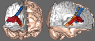 Renderings of the Brain's 'Braking' Network