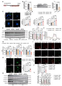 Fig.3. The loss of KIF13B disrupts lipid metabolism and the mitochondrial electron transfer chain function in cardiomyocytes under sepsis stress