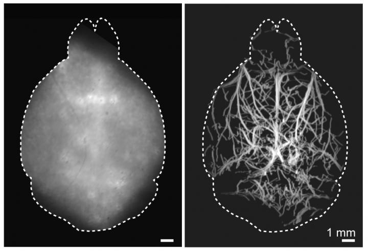 Brain Images