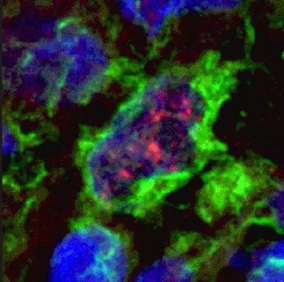 Human Dendritic Cells in Leprosy