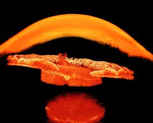 Intraocular lens simulation