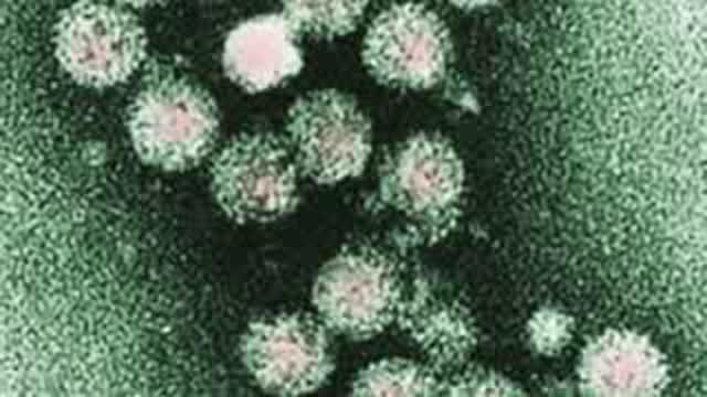 Solving the HCV Epidemic among People with Substance Abuse Disorders