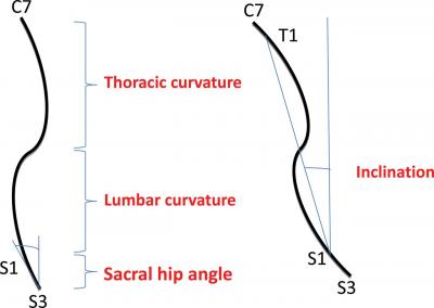 Spinal Posture