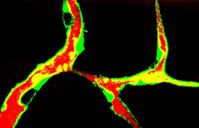 AIBP Zebrafish