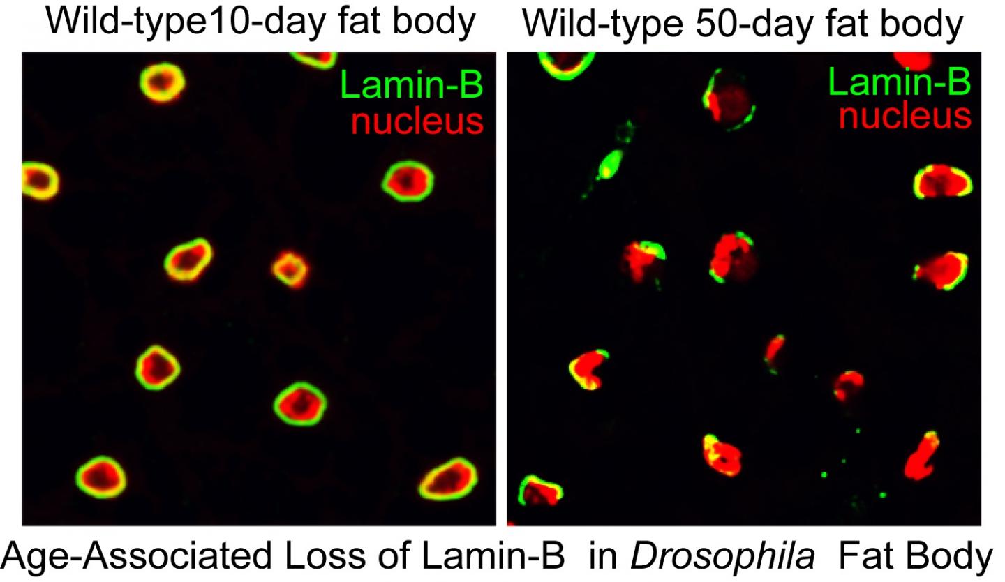 Aging Fruit Fly Fat Bodies