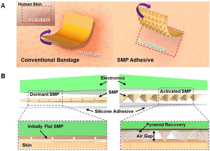 Schematic Diagram of a Shape-Memory Polymer-Based Adhesive Patch