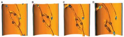 Quantum Tornadoes in Stirred Superfluids (3 of 3)