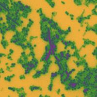 Gut Bacteria Micrograph