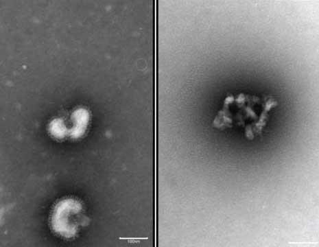Urumin and Flu