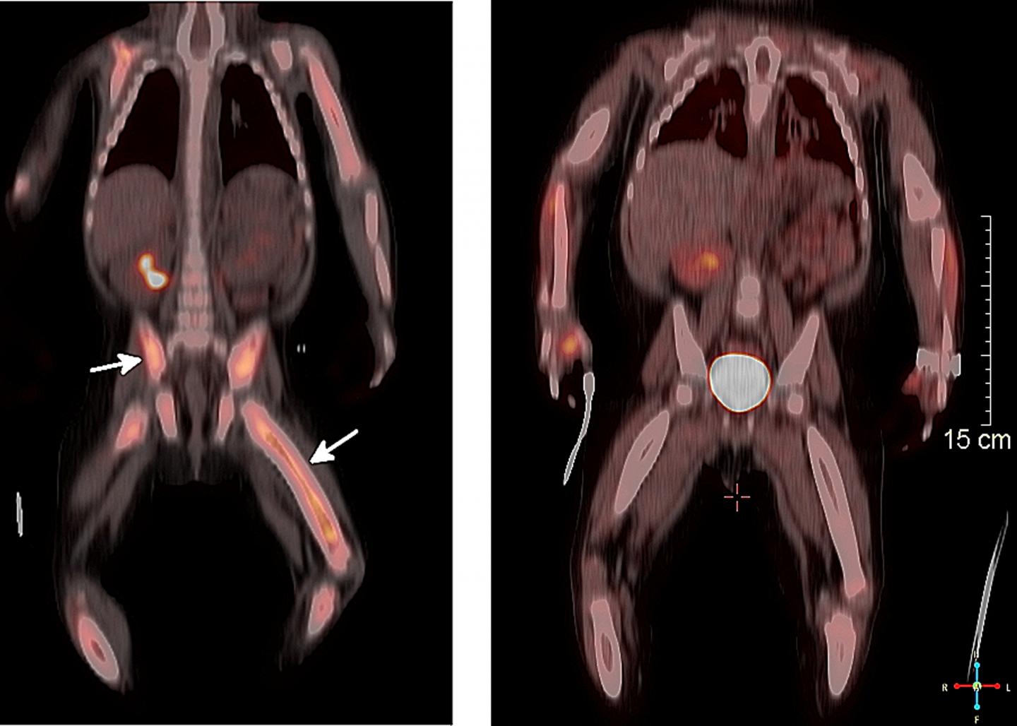 Oral Therapy, Improved Outcome