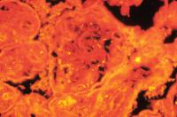 <i>Treponema pallidum</i> Bacteria