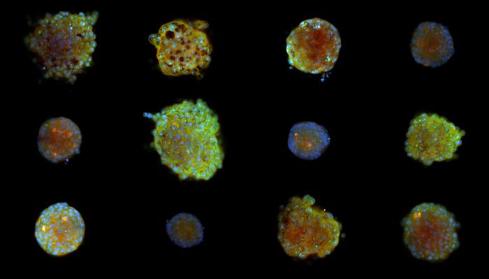 Various cleared spheroids in three colours upon drug perturbation