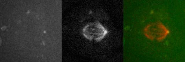 Microtubules in Mitotic Spindle