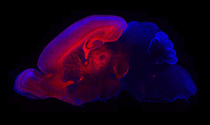 Neurons and Glia