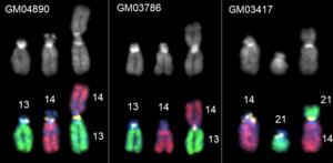 Robertsonian fusion chromosomes