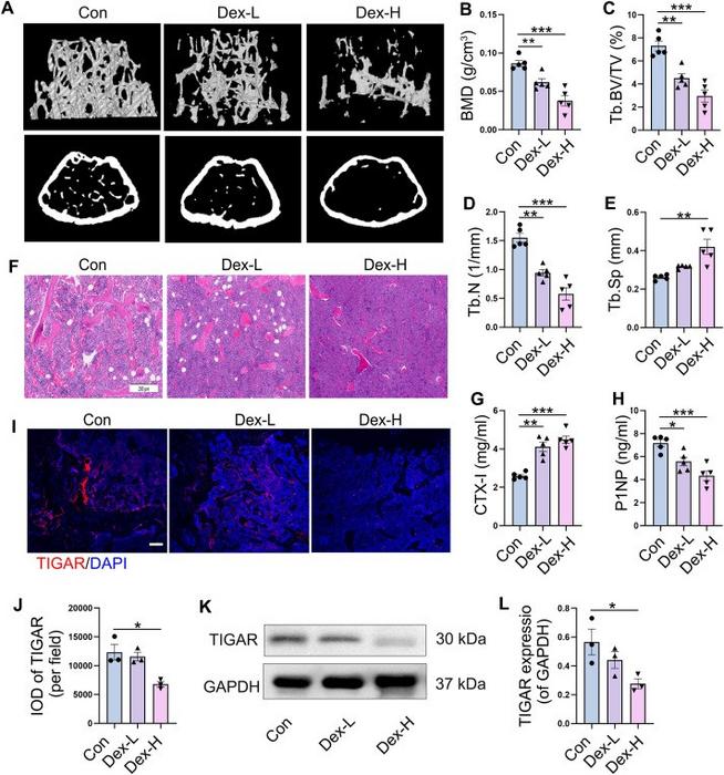 Effects of dexamethasone (Dex) on bone microstructure and TIGAR expression in femur of mice.