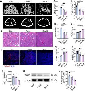 Effects of dexamethasone (Dex) on bone microstructure and TIGAR expression in femur of mice.