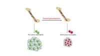Neutrophils