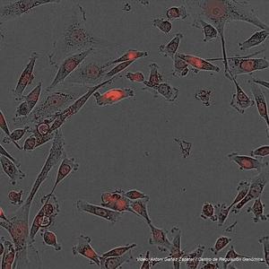 Triple negative breast cancer cells in vitro