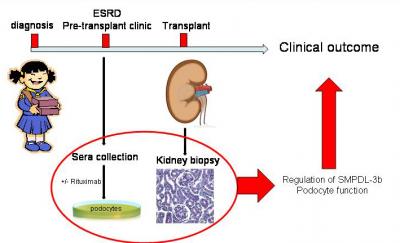 Pinpointing How Rituximab Stops Leaky Kidneys (2 of 2)