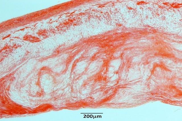 Diseased Canine Valve