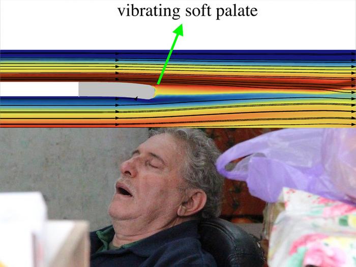 Simulation of airflow over the soft palate, over an image of a man sleeping