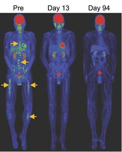PET/CT images