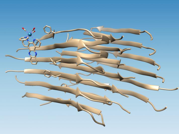 AMYLOID 1