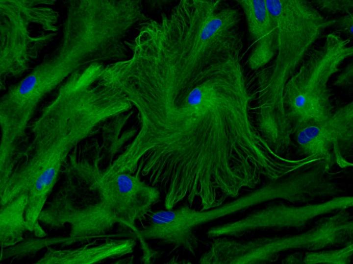 Primary culture of astrocytes © Inserm/Ruiz, Anne-Laure