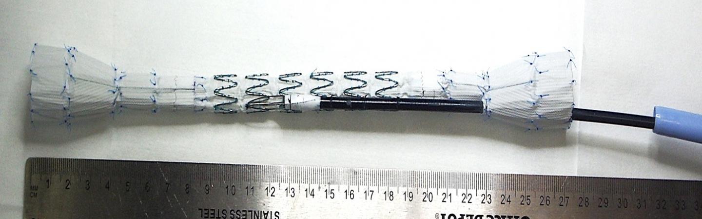 Organ Stent