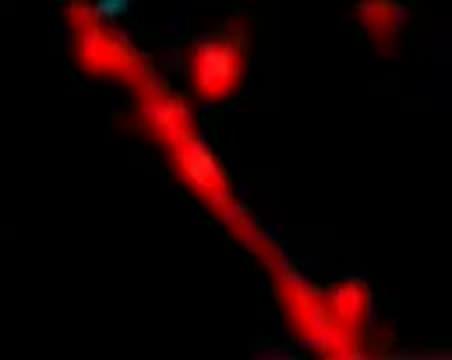 CyRFP1/GCaMP6s in vivo Imaging