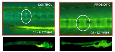 Development of Zebrafish Vertebrae