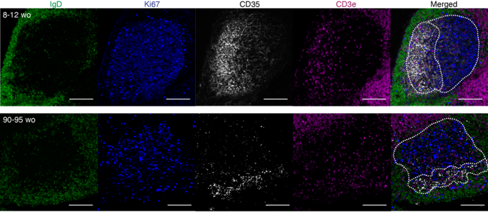 Microscopy image of a germinal centre structure which is altered in aged mice.