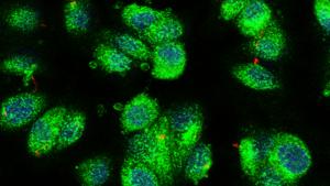 Gene variant, CREB3