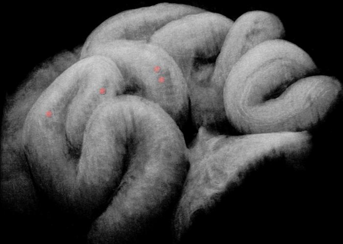 in vivo 3D OCT image