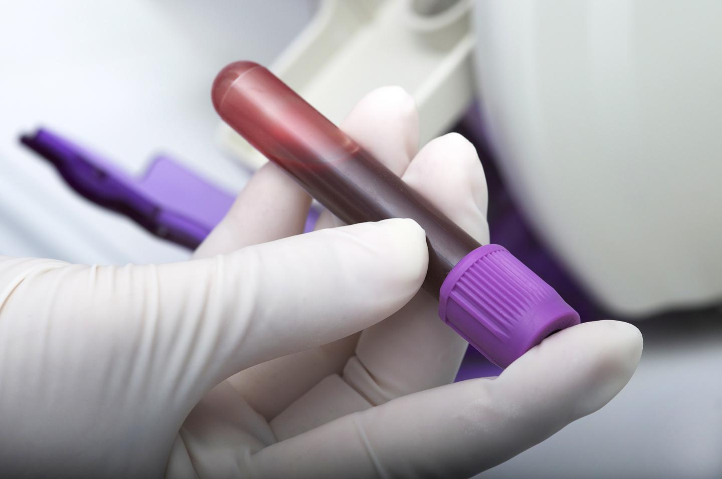 Blood Test