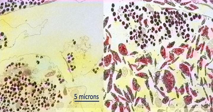 Sepsis platelets, University of California San Diego