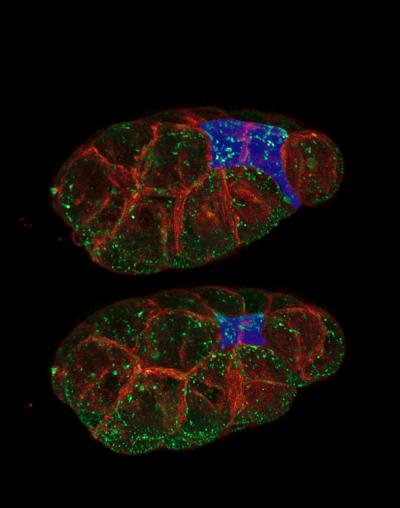 Under the Microscope, Shape-Shifting Cells (2 of 5)