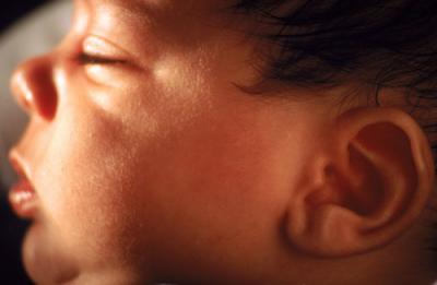 Enzyme Controlling Cell Death Paves Way for Treatment of Brain Damage in Newborns