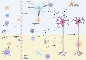 Shared immune features in Parkinson's disease and multiple sclerosis