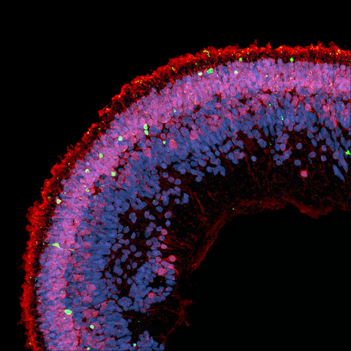 Retinal Organoid
