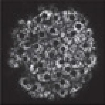Pancreatic Islet