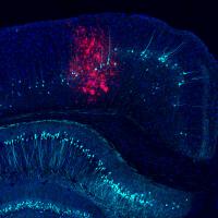 Salk Scientists Discover How to Prevent Undesirable Immune Attacks on Therapeutic Viruses