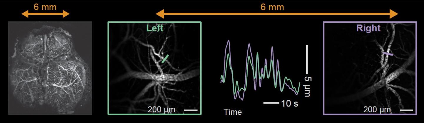 Brain Tracking