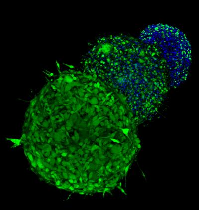 Conquering Drug-Resistant Melanoma