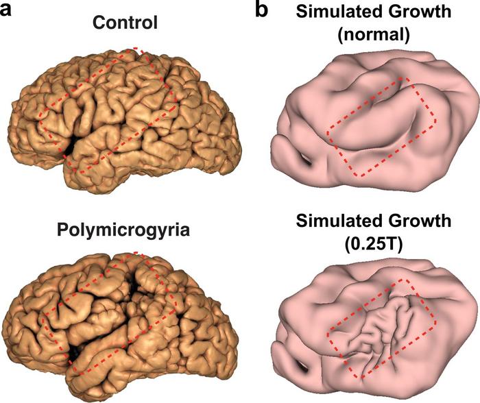 brain-comparison