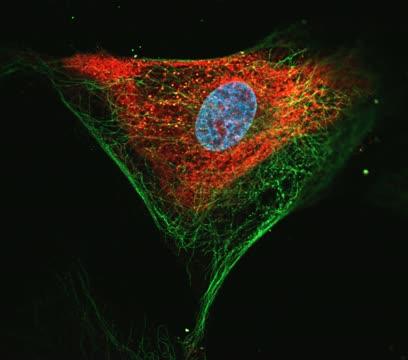 Zika Virus and Its Potential as Therapy against Brain Tumors