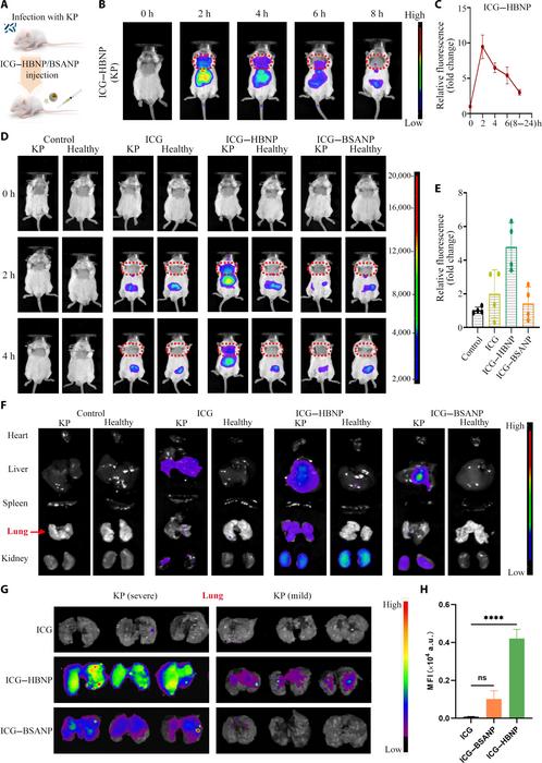 The ability of HBNPs to target K. pneumoniae and antibacterial activity in vivo