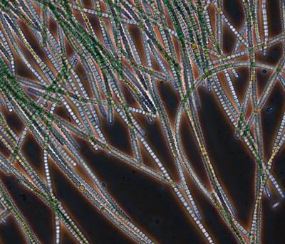 Cyanobacterium