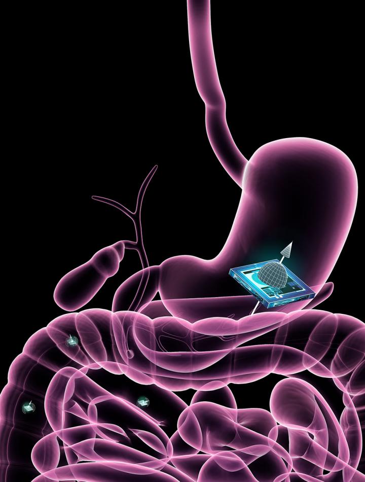 Illustration of Microchip in the Gut